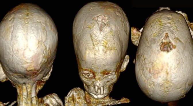 Ancient Egyptian Child Mummies Show High Rates Of Anemia